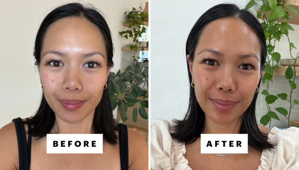 writer sara tan before and after trying a compounded copper peptide cream